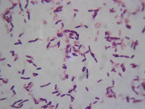 1593414730280052.jpg timg (1).jpg